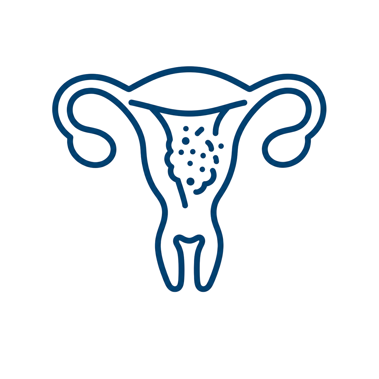 cancer de endometrio